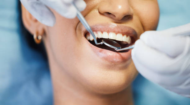 Best Emergency Dentist for Knocked-Out Tooth in Yorktown, TX